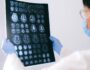 Neuralink e o uso de chips cerebrais em humanos - Quero Mais Tecnologia