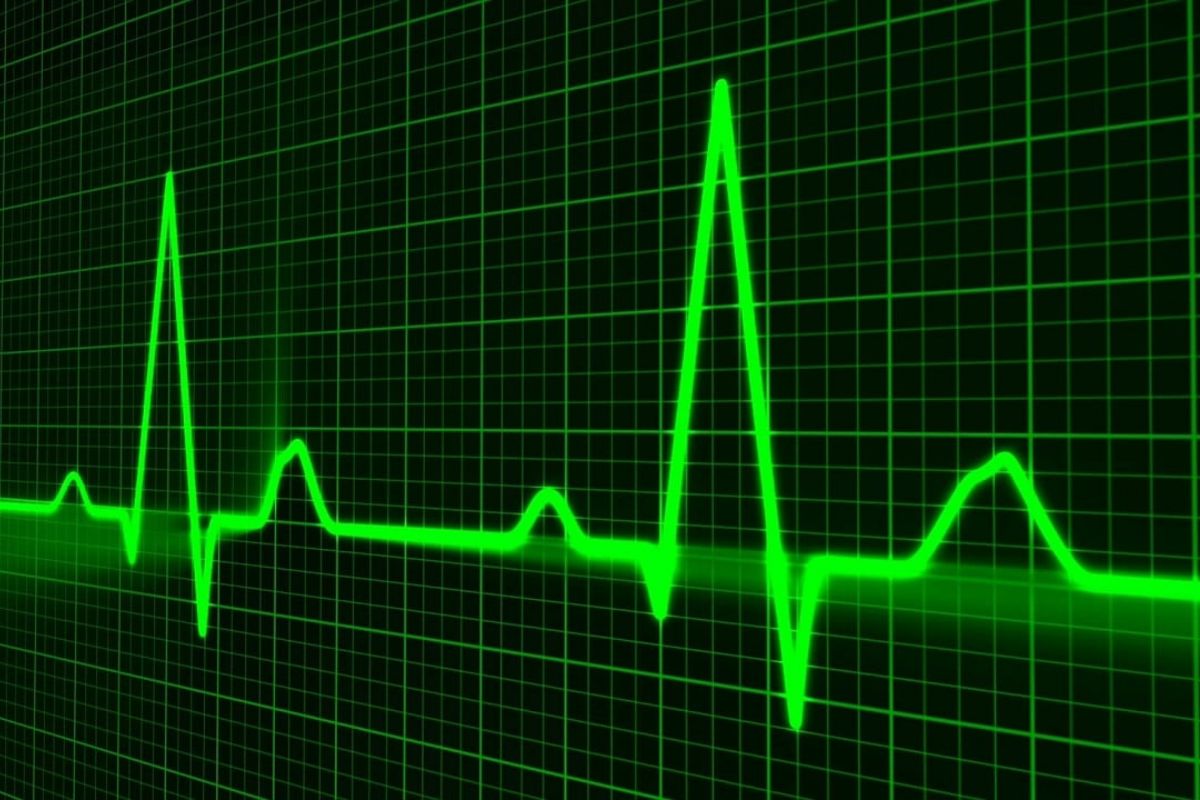 Gráficos com demonstração de batimentos cardíacos de pessoa em hospital atualizando em tempo real mostrando a importância da Tecnologia na saúde